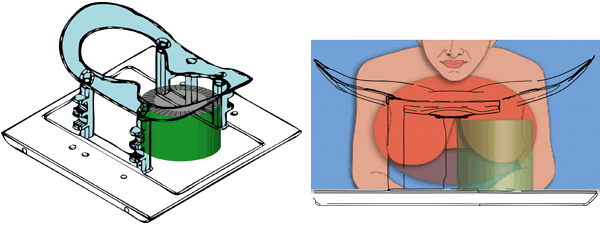 Drawings of the simultaneous PET/MRI breast imaging system